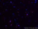 IBA1 Antibody in Immunohistochemistry (PFA fixed) (IHC (PFA))