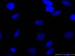 ARL13B Antibody in Immunocytochemistry (ICC/IF)