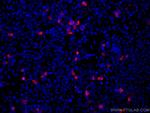 MYC tag Antibody in Immunocytochemistry (ICC/IF)