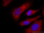 Annexin V Antibody in Immunocytochemistry (ICC/IF)