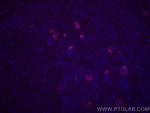 Endoglin/CD105 Antibody in Immunohistochemistry (Paraffin) (IHC (P))