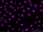 HDAC2 Antibody in Immunocytochemistry (ICC/IF)