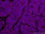 NCAPH Antibody in Immunohistochemistry (Paraffin) (IHC (P))