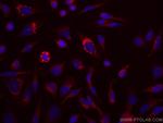 EPRS Antibody in Immunocytochemistry (ICC/IF)