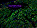 smooth muscle actin Antibody in Immunohistochemistry (Paraffin) (IHC (P))