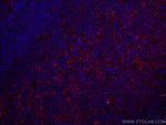 CD70 Antibody in Immunohistochemistry (Paraffin) (IHC (P))