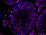 EED Antibody in Immunohistochemistry (Paraffin) (IHC (P))