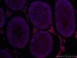 EED Antibody in Immunohistochemistry (Paraffin) (IHC (P))