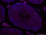 SMCR7L Antibody in Immunohistochemistry (Paraffin) (IHC (P))