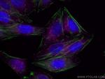 HGS Antibody in Immunocytochemistry (ICC/IF)