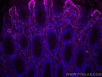 Collagen Type III Antibody in Immunohistochemistry (Paraffin) (IHC (P))