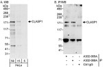 CLASP1 Antibody in Western Blot (WB)