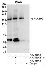 CLASP2 Antibody in Western Blot (WB)