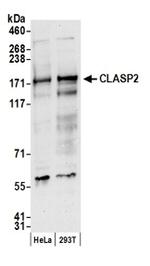 CLASP2 Antibody in Western Blot (WB)