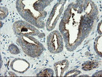 CLEC4E Antibody in Immunohistochemistry (Paraffin) (IHC (P))