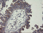 CLEC4E Antibody in Immunohistochemistry (Paraffin) (IHC (P))