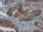 CLEC4E Antibody in Immunohistochemistry (Paraffin) (IHC (P))