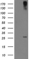 CLEC4E Antibody in Western Blot (WB)