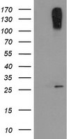 CLEC4E Antibody in Western Blot (WB)