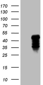 CLEC4M Antibody in Western Blot (WB)