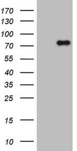 CLINT1 Antibody in Western Blot (WB)