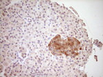 CLOCK Antibody in Immunohistochemistry (Paraffin) (IHC (P))