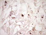 CLOCK Antibody in Immunohistochemistry (Paraffin) (IHC (P))