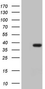 CLOCK Antibody in Western Blot (WB)