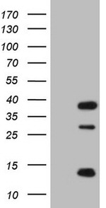 CLOCK Antibody in Western Blot (WB)