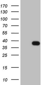 CLOCK Antibody in Western Blot (WB)