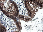 CMPK1 Antibody in Immunohistochemistry (Paraffin) (IHC (P))