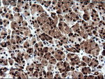 CMPK1 Antibody in Immunohistochemistry (Paraffin) (IHC (P))