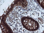 CMPK1 Antibody in Immunohistochemistry (Paraffin) (IHC (P))