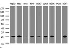 CMPK1 Antibody in Western Blot (WB)