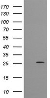 CMPK1 Antibody in Western Blot (WB)