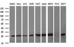 CMPK1 Antibody in Western Blot (WB)