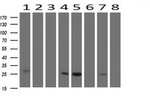 CMPK1 Antibody in Western Blot (WB)