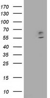 CNDP1 Antibody in Western Blot (WB)