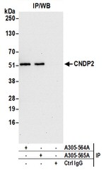 CNDP2 Antibody in Immunoprecipitation (IP)