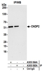 CNDP2 Antibody in Western Blot (WB)