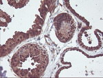 CNDP2 Antibody in Immunohistochemistry (Paraffin) (IHC (P))