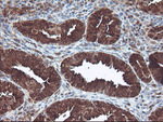 CNDP2 Antibody in Immunohistochemistry (Paraffin) (IHC (P))