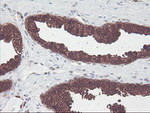 CNDP2 Antibody in Immunohistochemistry (Paraffin) (IHC (P))