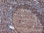 CNDP2 Antibody in Immunohistochemistry (Paraffin) (IHC (P))