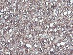 CNDP2 Antibody in Immunohistochemistry (Paraffin) (IHC (P))