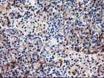 CNDP2 Antibody in Immunohistochemistry (Paraffin) (IHC (P))