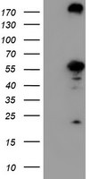 CNDP2 Antibody in Western Blot (WB)