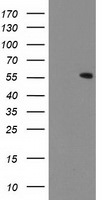 CNDP2 Antibody in Western Blot (WB)