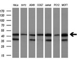 CNDP2 Antibody in Western Blot (WB)