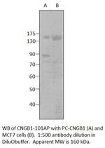 GARP Antibody in Western Blot (WB)